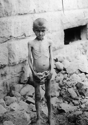 One of many orphaned Armenian children found naked and starving 